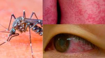 Virus Zika: possibili misure di prevenzione!